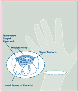 CarpalTunnel1